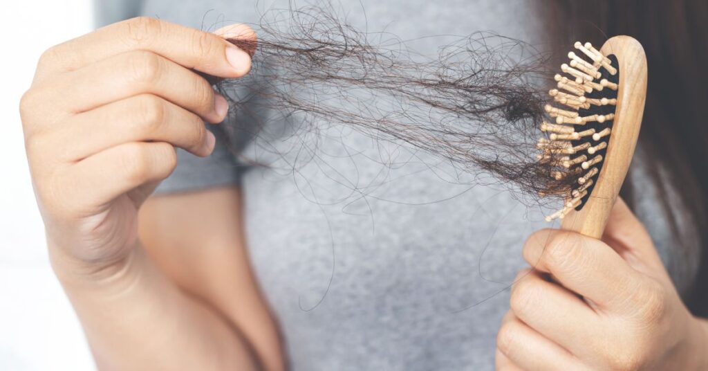 Alopecia (Căderea părului) 1 Alopecia