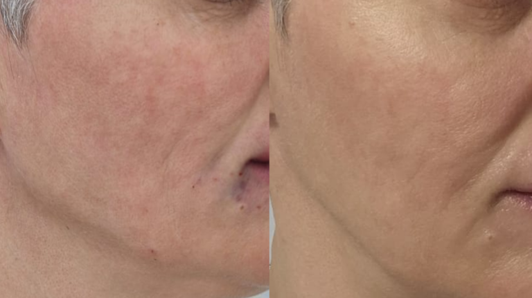 polinucleotide